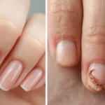 How can you tell if your nails are healthy or need care?