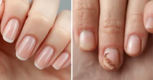 How can you tell if your nails are healthy or need care?